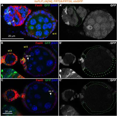 Epithelial morphogenesis in the Drosophila egg chamber requires Parvin and ILK